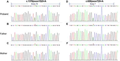 Case report: Comprehensive exploration of a novel PFKM mutation in glycogen storage disease Type VII